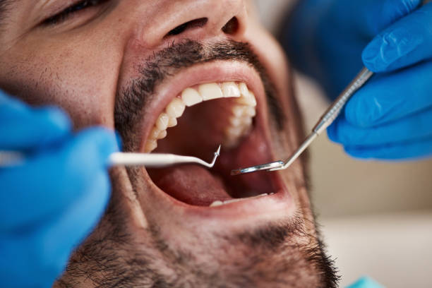 Emergency Dental Services in Phenix City, AL
